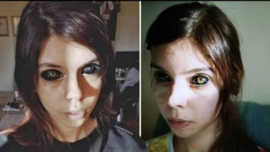 Photo of Si tatua il bulbo oculare come il suo rapper preferito: 25 enne resta cieca
